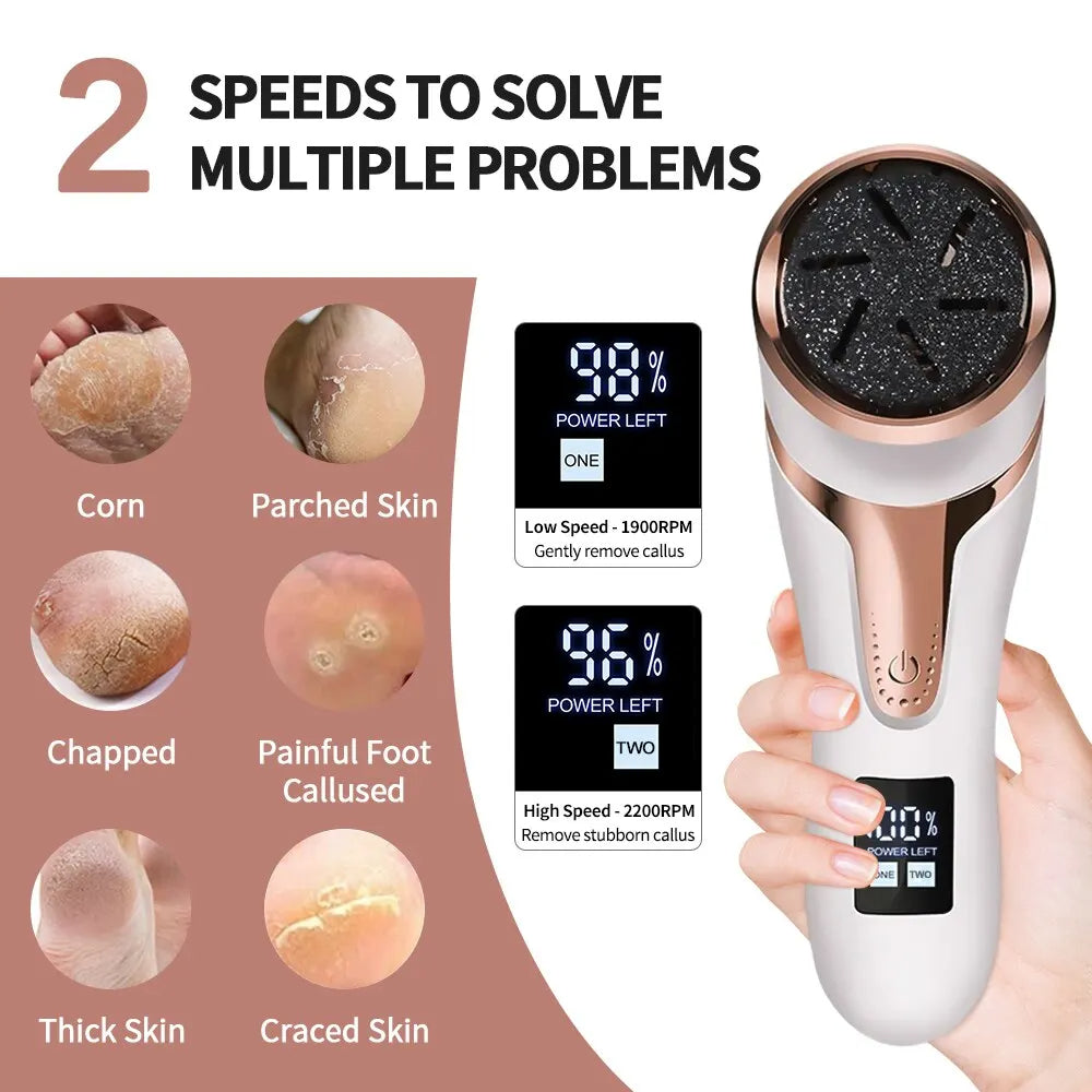 SmoothStep™ – Rechargeable Foot Callus & Dead Skin Remover